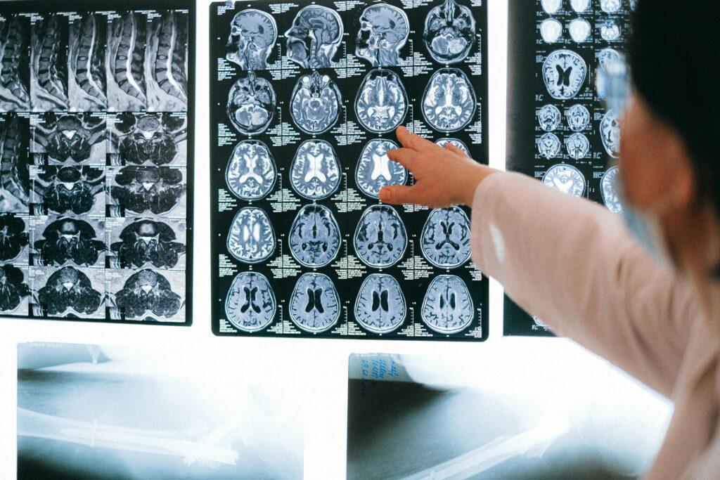 A doctor pointing at a scan